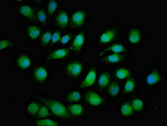 Immunocytochemistry/ Immunofluorescence - Anti-TOB antibody (AB236859)