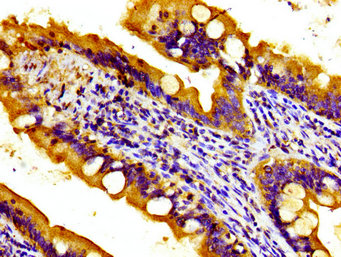 Immunohistochemistry (Formalin/PFA-fixed paraffin-embedded sections) - Anti-TOB antibody (AB236859)