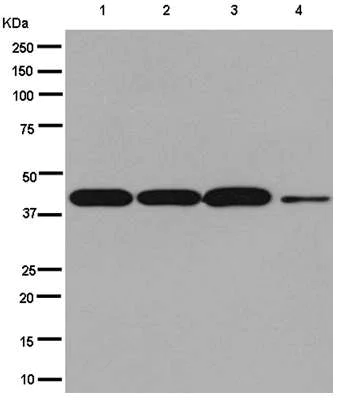 Western blot - Anti-TOB2 antibody [EPR12588] - N-terminal (AB180514)