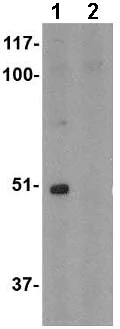 Western blot - Anti-Toca-1 antibody (AB67310)