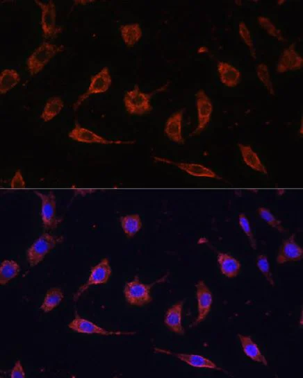 Immunocytochemistry/ Immunofluorescence - Anti-Tollip antibody (AB187198)