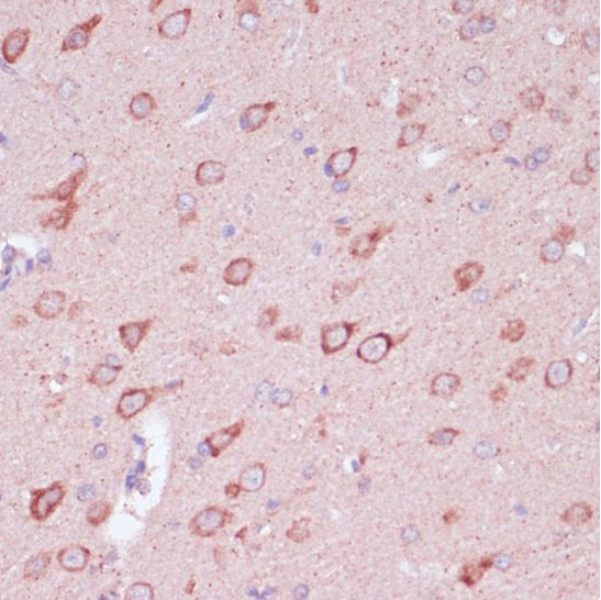 Immunohistochemistry (Formalin/PFA-fixed paraffin-embedded sections) - Anti-Tollip antibody (AB187198)