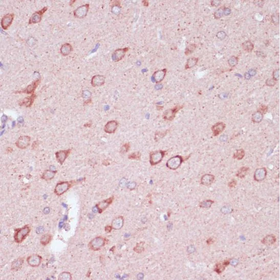 Immunohistochemistry (Formalin/PFA-fixed paraffin-embedded sections) - Anti-Tollip antibody (AB187198)