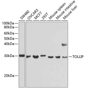 Western blot - Anti-Tollip antibody (AB187198)