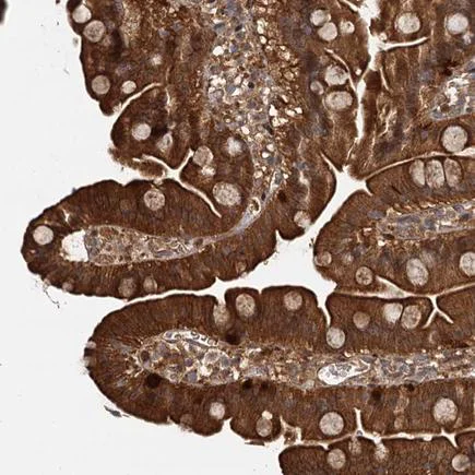 Immunohistochemistry (Formalin/PFA-fixed paraffin-embedded sections) - Anti-Tollip antibody (AB223763)