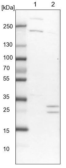 Western blot - Anti-Tollip antibody (AB223763)