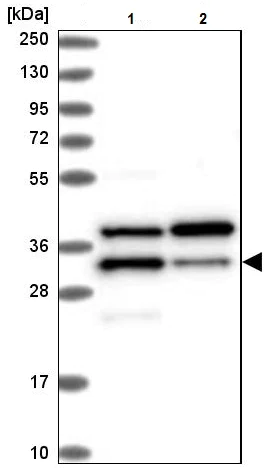 Western blot - Anti-Tollip antibody (AB223763)