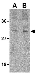 Western blot - Anti-Tollip antibody (AB37155)