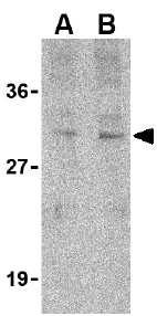 Western blot - Anti-Tollip antibody (AB37155)