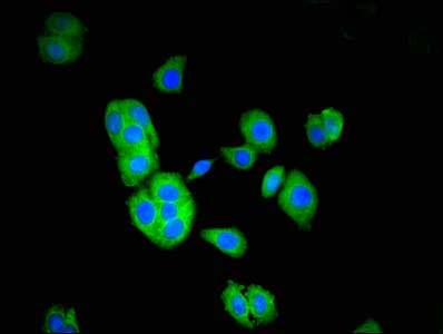 Immunocytochemistry/ Immunofluorescence - Anti-TOM1 antibody (AB236863)