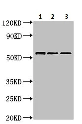 Western blot - Anti-TOM1 antibody (AB236863)