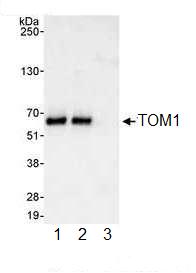 Immunoprecipitation - Anti-TOM1 antibody (AB99356)