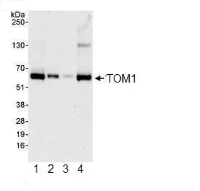 Western blot - Anti-TOM1 antibody (AB99356)