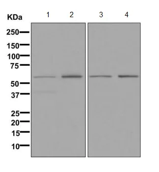 Western blot - Anti-TOM1 antibody [EPR11988(B)] (AB170866)