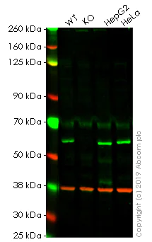 Western blot - Anti-TOM1 antibody [EPR11988(B)] - BSA and Azide free (AB249549)