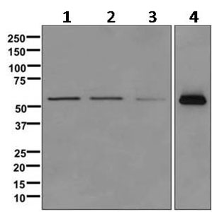 Western blot - Anti-TOM1 antibody [EPR11989(B)] (AB170928), expandable thumbnail