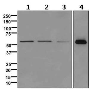 Western blot - Anti-TOM1 antibody [EPR11989(B)] (AB170928)