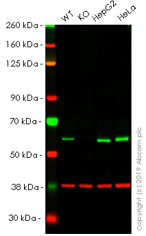 Western blot - Anti-TOM1 antibody [EPR11989(B)] - BSA and Azide free (AB249599)