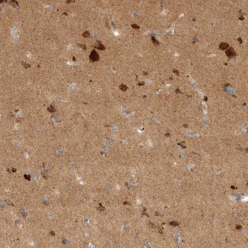 Immunohistochemistry (Formalin/PFA-fixed paraffin-embedded sections) - Anti-TOM1L2 antibody (AB121716)