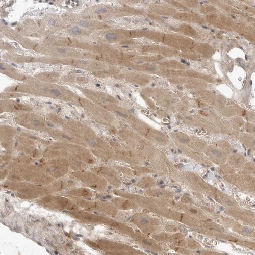 Immunohistochemistry (Formalin/PFA-fixed paraffin-embedded sections) - Anti-TOM1L2 antibody (AB121716)