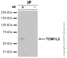 Immunoprecipitation - Anti-TOM1L2 antibody (AB96320), expandable thumbnail