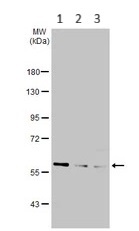 Western blot - Anti-TOM1L2 antibody (AB96320)
