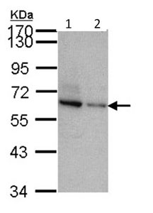 Western blot - Anti-TOM1L2 antibody (AB96320), expandable thumbnail