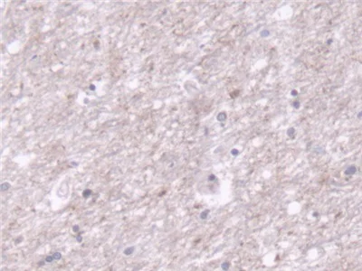 Immunohistochemistry (Formalin/PFA-fixed paraffin-embedded sections) - Anti-TOM70 antibody (AB233407)