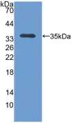 Western blot - Anti-TOM70 antibody (AB233407)
