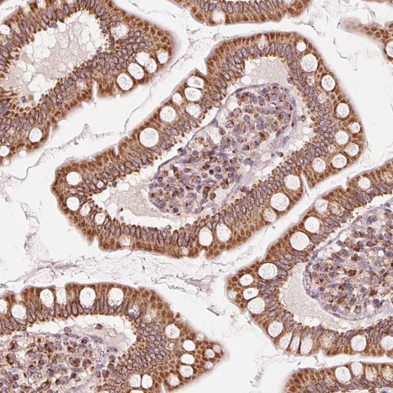 Immunohistochemistry (Formalin/PFA-fixed paraffin-embedded sections) - Anti-TOM70 antibody (AB251925)