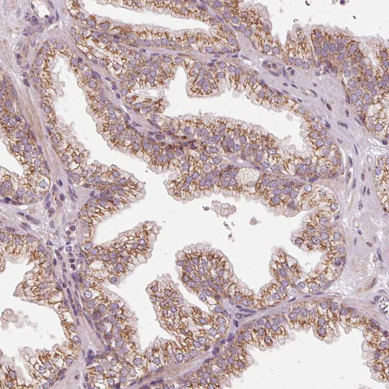 Immunohistochemistry (Formalin/PFA-fixed paraffin-embedded sections) - Anti-TOM70 antibody (AB251925)