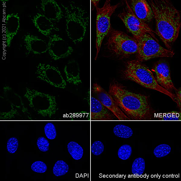 Immunocytochemistry/ Immunofluorescence - Anti-TOM70 antibody [EPR26576-162] (AB289977)