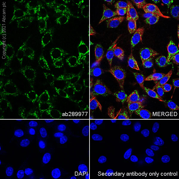 Immunocytochemistry/ Immunofluorescence - Anti-TOM70 antibody [EPR26576-162] (AB289977)