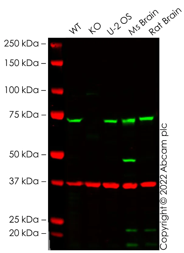 Western blot - Anti-TOM70 antibody [EPR26576-162] - BSA and Azide free (AB290002)
