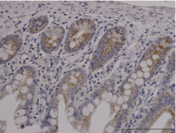 Immunohistochemistry (Formalin/PFA-fixed paraffin-embedded sections) - Anti-TOMM20 antibody [4F3] - BSA and Azide free (AB56783)