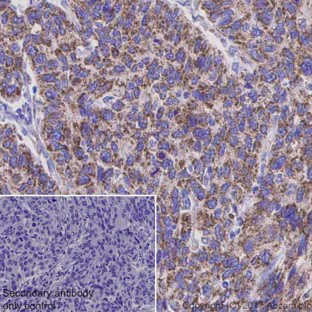 Immunohistochemistry (Formalin/PFA-fixed paraffin-embedded sections) - Anti-TOMM20 antibody [EPR15581-39] - Mitochondrial Marker (AB186734)