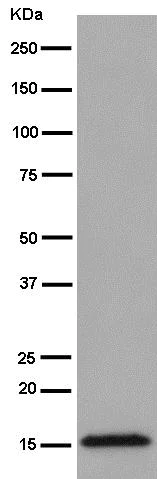 Western blot - Anti-TOMM20 antibody [EPR15581-39] - Mitochondrial Marker (AB186734)