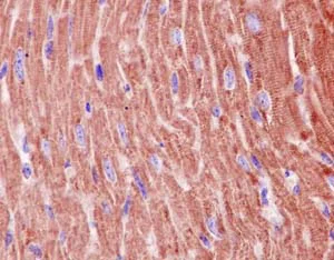 rthomol immun 30本 Suppression of antitumor T cell immunity by the