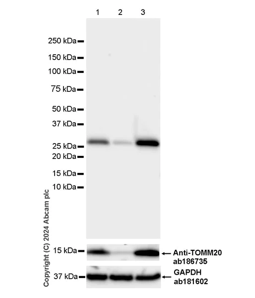 Western blot - Anti-TOMM20 antibody [EPR15581-54] - Mitochondrial Marker (AB186735)