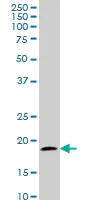 Western blot - Anti-TOMM22/TOM22 antibody [4G4] (AB57523)