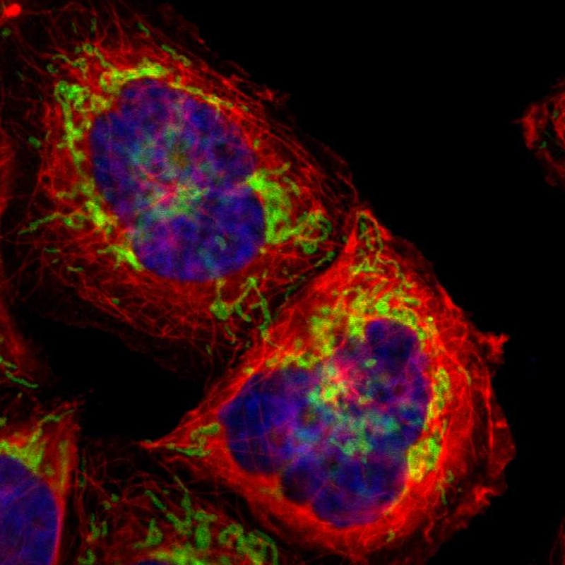 Immunocytochemistry/ Immunofluorescence - Anti-TOMM22/TOM22 antibody (AB246862), expandable thumbnail