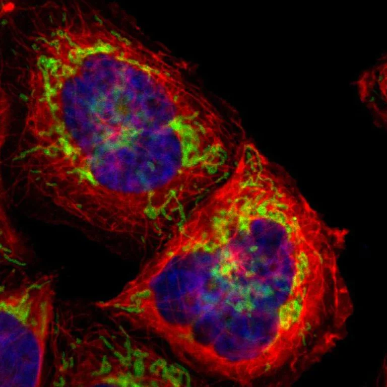 Immunocytochemistry/ Immunofluorescence - Anti-TOMM22/TOM22 antibody (AB246862)