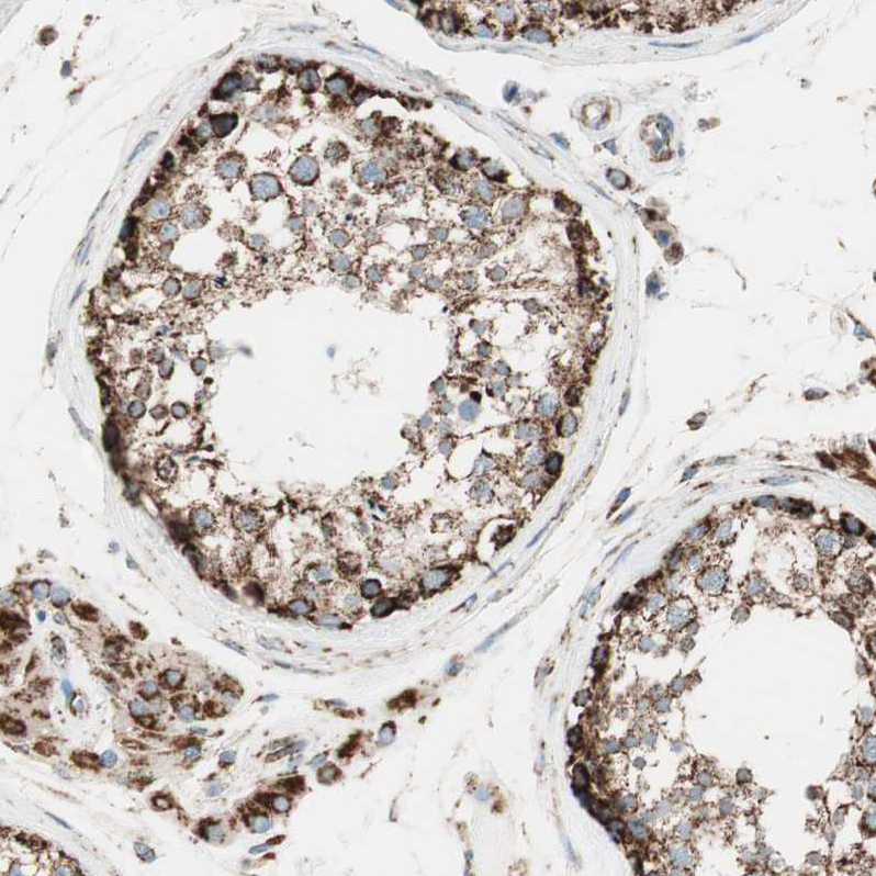 Immunohistochemistry (Formalin/PFA-fixed paraffin-embedded sections) - Anti-TOMM22/TOM22 antibody (ab246862), expandable thumbnail