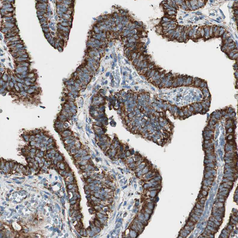 Immunohistochemistry (Formalin/PFA-fixed paraffin-embedded sections) - Anti-TOMM22/TOM22 antibody (AB246862), expandable thumbnail