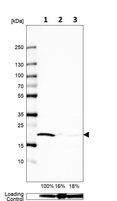 Western blot - Anti-TOMM22/TOM22 antibody (AB246862), expandable thumbnail