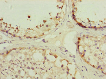 Immunohistochemistry (Formalin/PFA-fixed paraffin-embedded sections) - Anti-TOMM34 antibody (AB230103)