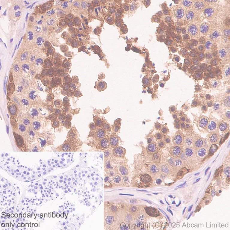 Immunohistochemistry (Formalin/PFA-fixed paraffin-embedded sections) - Anti-TOMM34 antibody [EPR30572-504] (AB324735)