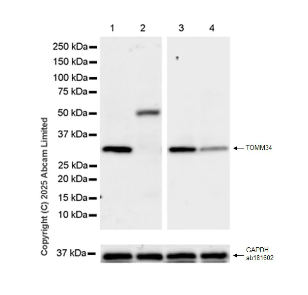 Western blot - Anti-TOMM34 antibody [EPR30572-504] (AB324735)