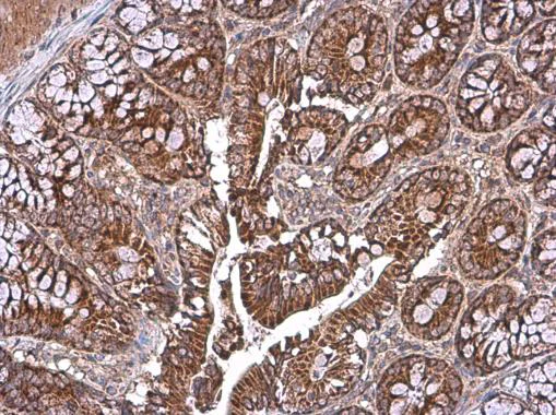 Immunohistochemistry (Formalin/PFA-fixed paraffin-embedded sections) - Anti-TOMM40 antibody (AB272921)