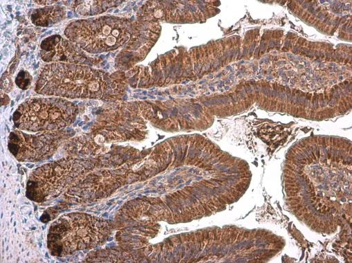 Immunohistochemistry (Formalin/PFA-fixed paraffin-embedded sections) - Anti-TOMM40 antibody (AB272921)